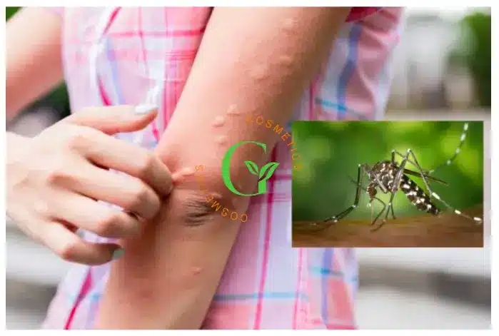 Công dụng của kem đuổi muỗi Kem đuổi muỗi có công dụng gì?