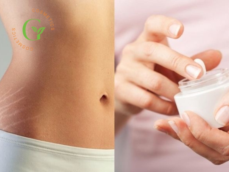 Gia công sản phẩm trị rạn da tại Omigos