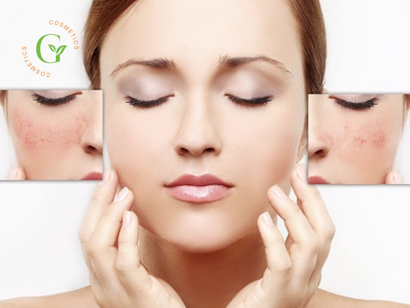 Hyaluronic Acid Trong Mỹ Phẩm Hyaluronic Acid Trong Mỹ Phẩm