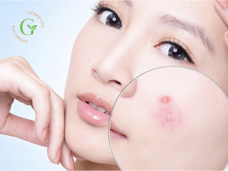 Salicylic Acid Có Tác Dụng Gì?