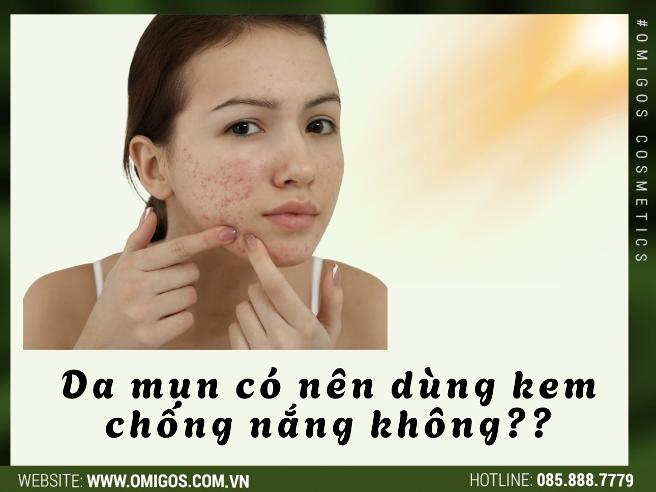 Da mụn dùng kem chống nắng - Nên hay không?